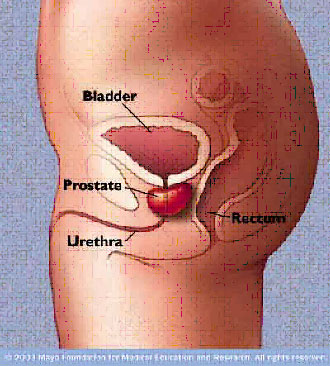 urinary-incontinence1