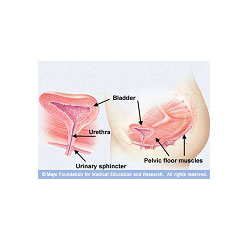 urinary-incontinence2